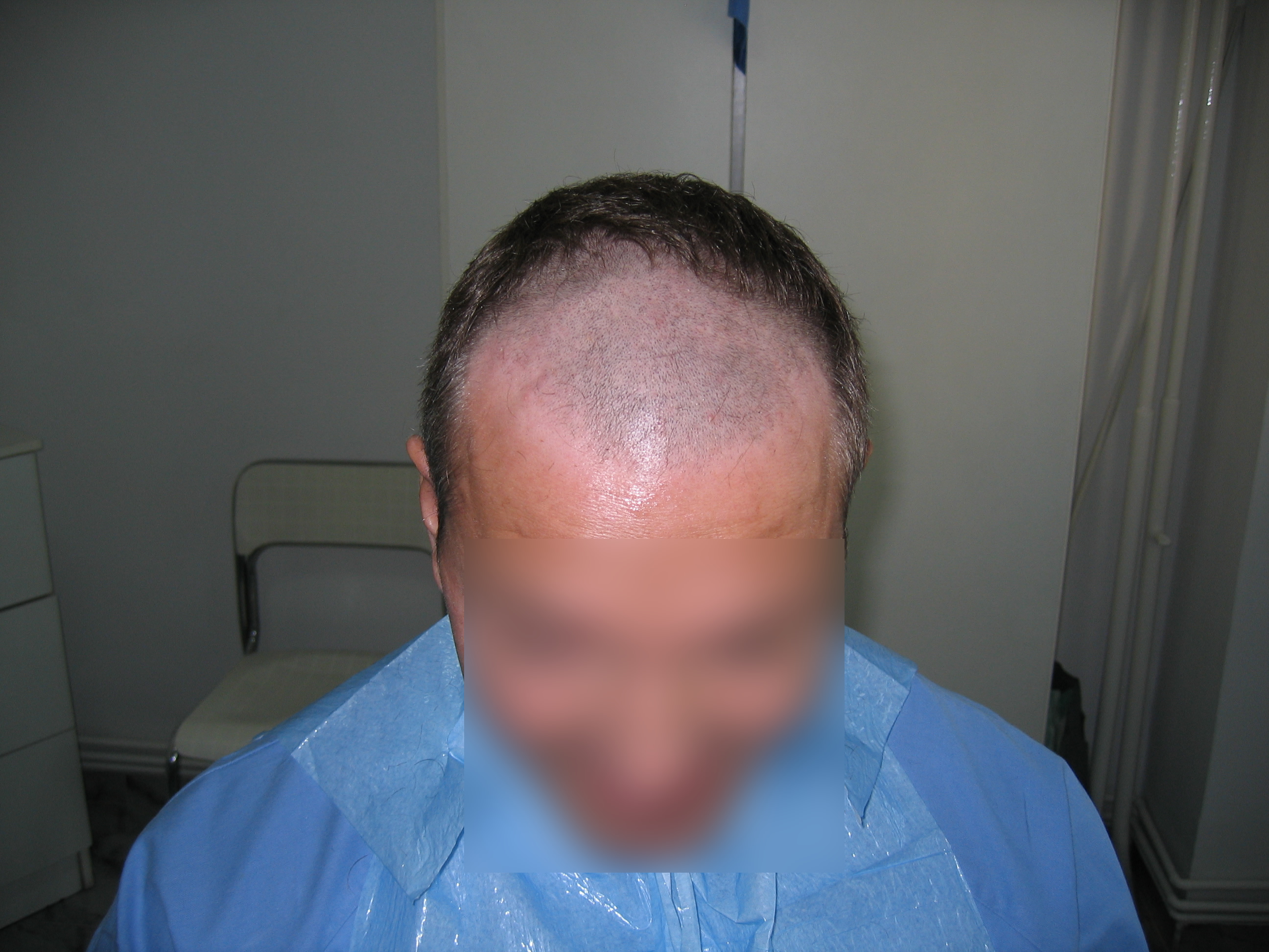 Result after