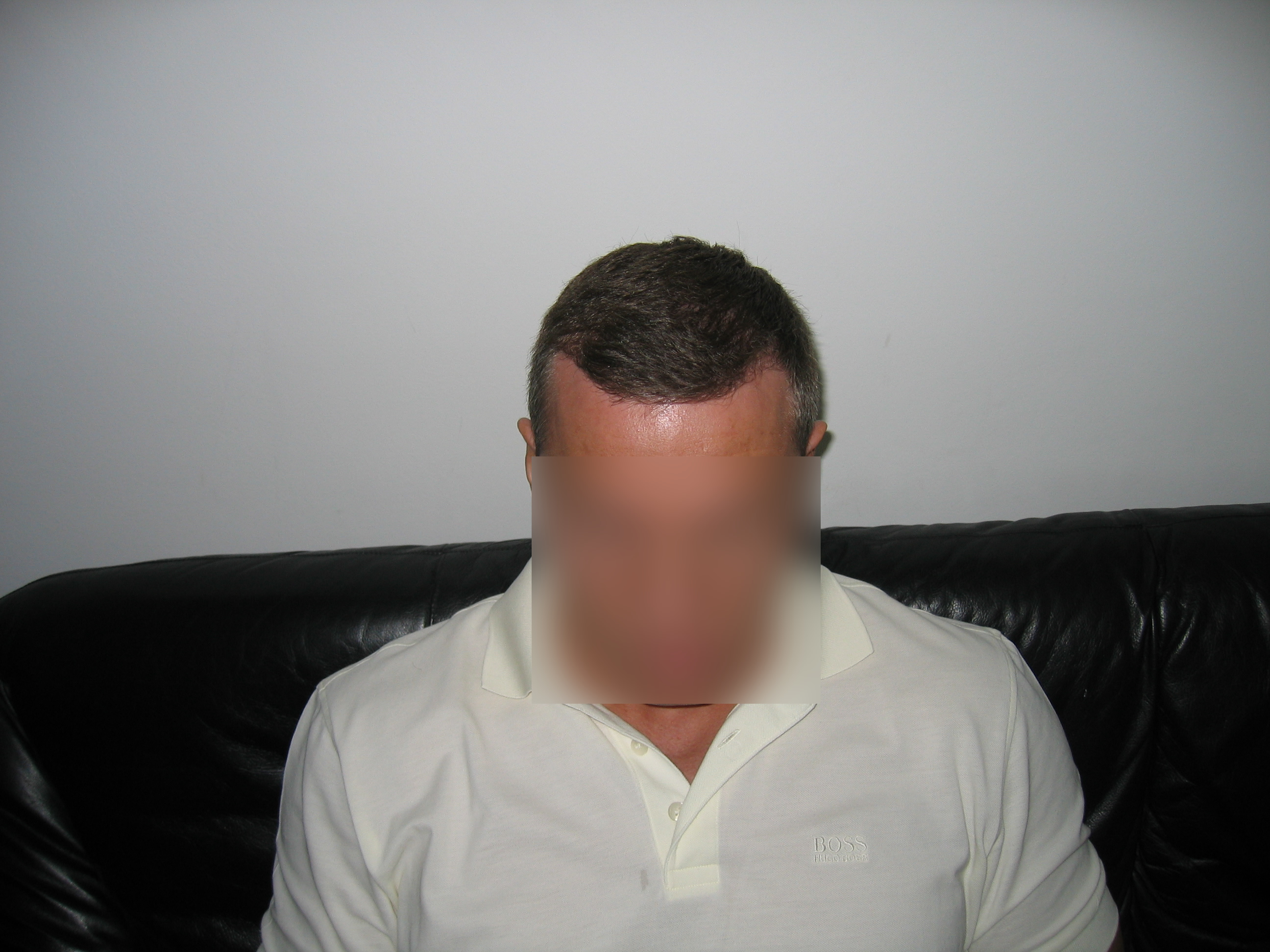 Result before