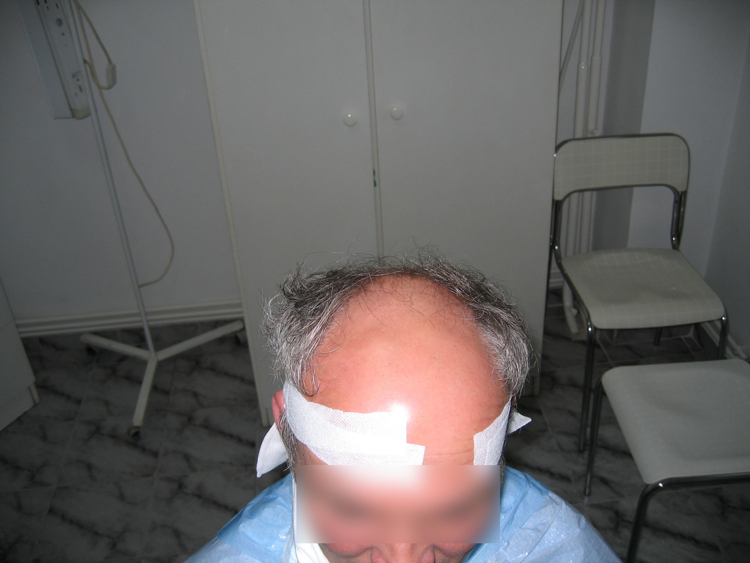 Result before