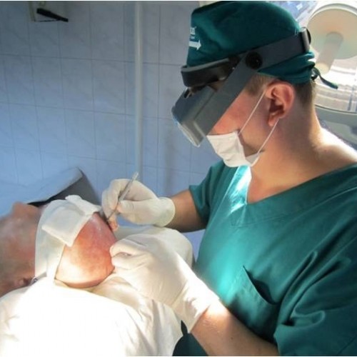 implant de par